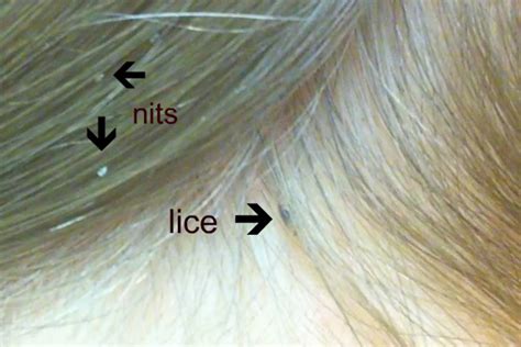 nits meaning.